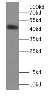 DAG1 Rabbit Polyclonal Antibody