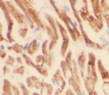 DAG1 Rabbit Polyclonal Antibody