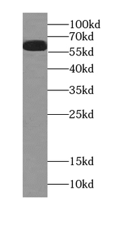 SLC1A1 Rabbit Polyclonal Antibody