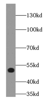 LPAR3 Rabbit Polyclonal Antibody