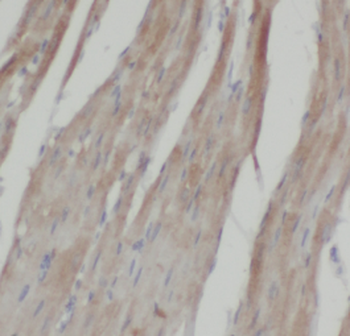 LPAR3 Rabbit Polyclonal Antibody