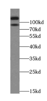 LIMA1 Antibody