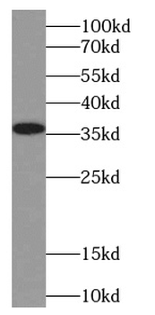 EXD1 Rabbit Polyclonal Antibody