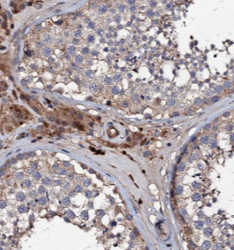 EXD1 Rabbit Polyclonal Antibody