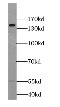 ESYT1 Rabbit Polyclonal Antibody