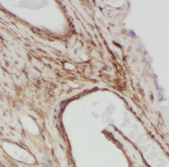 FBN2 Specific Rabbit Polyclonal Antibody