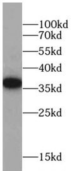 FOLR1 Mouse Monoclonal Antibody