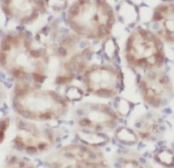FOLR1 Mouse Monoclonal Antibody