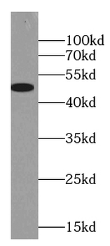 GLRA2 Rabbit Polyclonal Antibody
