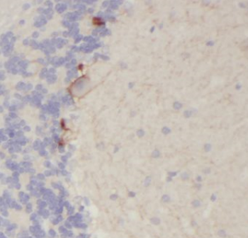 GLRA2 Rabbit Polyclonal Antibody