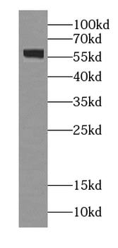 GPR101 Specific Rabbit Polyclonal Antibody