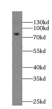 GPRIN3 Specific Rabbit Polyclonal Antibody