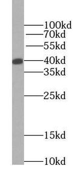 ADH5 Antibody