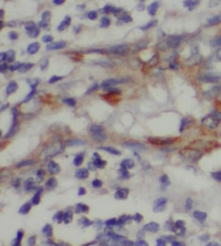 HERPUD1 Rabbit Polyclonal Antibody