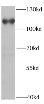 HIP1 Specific Rabbit Polyclonal Antibody