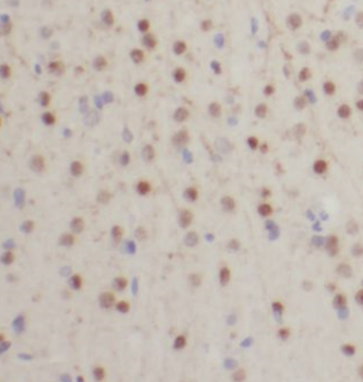 HIP1 Specific Rabbit Polyclonal Antibody