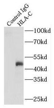 HLA-C Antibody