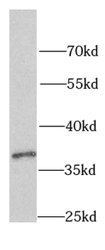 PCBP1 Rabbit Polyclonal Antibody
