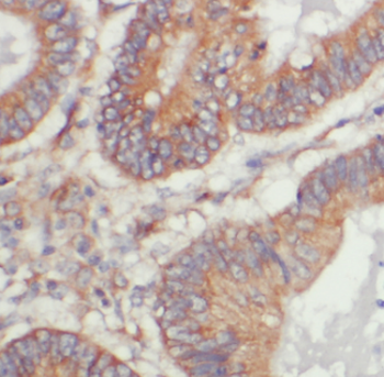 PCBP1 Rabbit Polyclonal Antibody