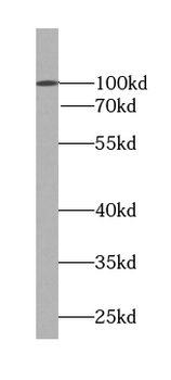 RNF31 Rabbit Polyclonal Antibody