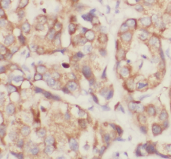 RNF31 Rabbit Polyclonal Antibody