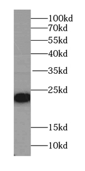 PSMC3IP Antibody