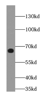 WNK1 Rabbit Polyclonal Antibody