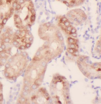 WNK1 Rabbit Polyclonal Antibody