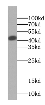 CLNS1A Rabbit Polyclonal Antibody