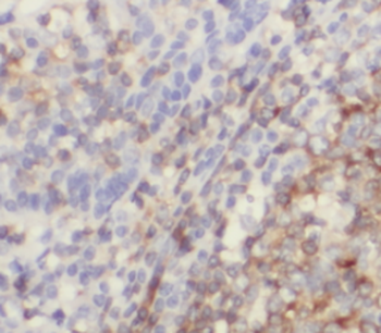 IL19 Antibody