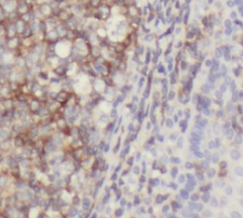IL9 Antibody