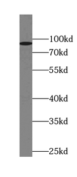 KPNB1 Antibody
