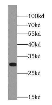 ING1 specific Rabbit Polyclonal Antibody