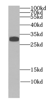 ING4 specific Rabbit Polyclonal Antibody