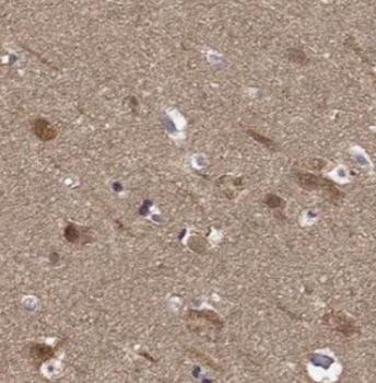 ING4 specific Rabbit Polyclonal Antibody