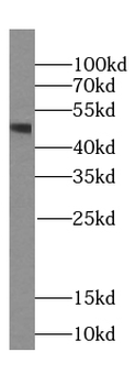 INHBA Specific Rabbit Polyclonal Antibody