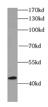 IVD Mouse Monoclonal Antibody