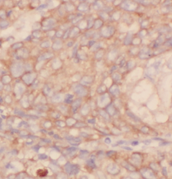 IVD Mouse Monoclonal Antibody