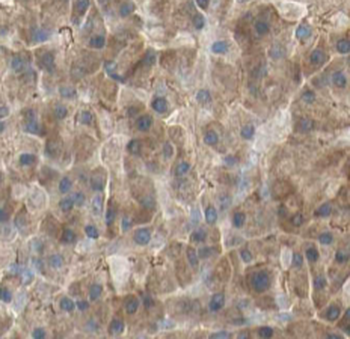 KLK1 Antibody