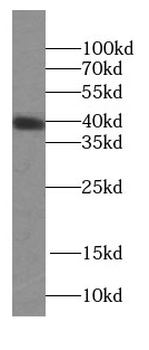 KLK11 Rabbit Polyclonal Antibody