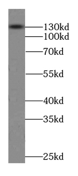 KCNB1 Specific Rabbit Polyclonal Antibody