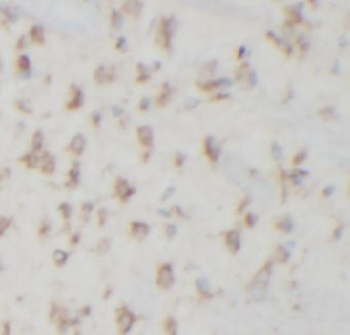 KCNB1 Specific Rabbit Polyclonal Antibody