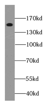 MTUS2 Rabbit Polyclonal Antibody