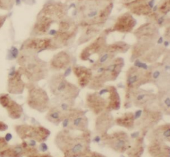 MTUS2 Rabbit Polyclonal Antibody