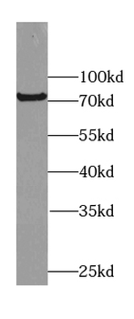 FERMT2 Rabbit Polyclonal Antibody