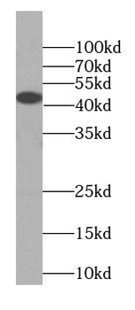 KISS1R Specific Rabbit Polyclonal Antibody