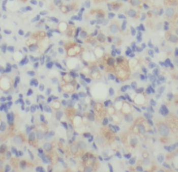 RPSA Antibody