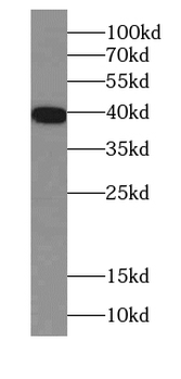 RPSA Antibody