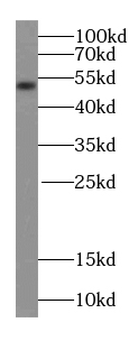 TMPO Rabbit Polyclonal Antibody