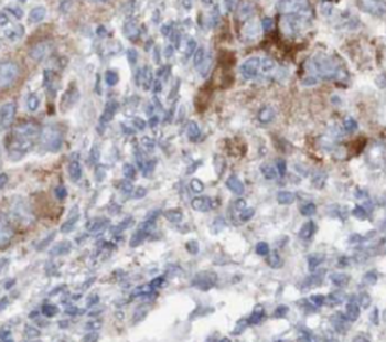 TMPO Rabbit Polyclonal Antibody
